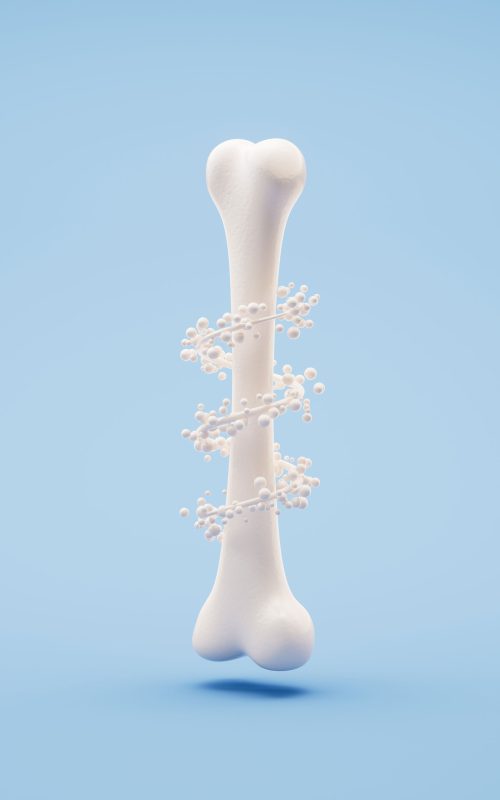 osteoporosi osteoporosi