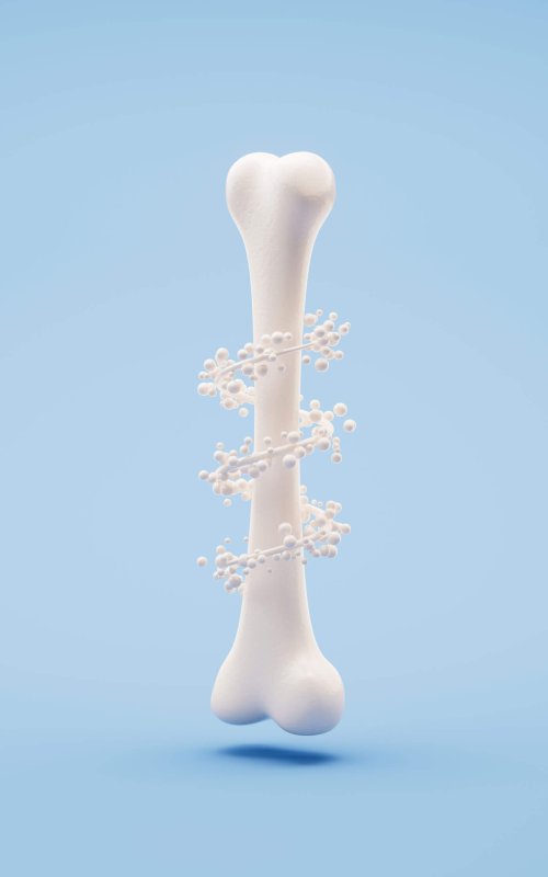 osteoporosi